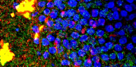 Pop microscopy
