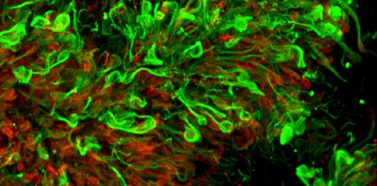 Pop microscopy